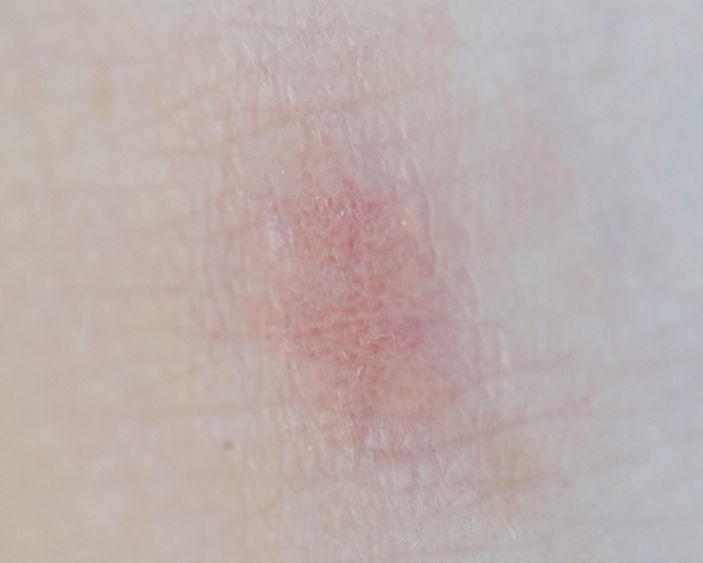 【小麦アレルギーかも？Vol.2／4】自分で気づく小麦アレルギーのサインとチェック方法